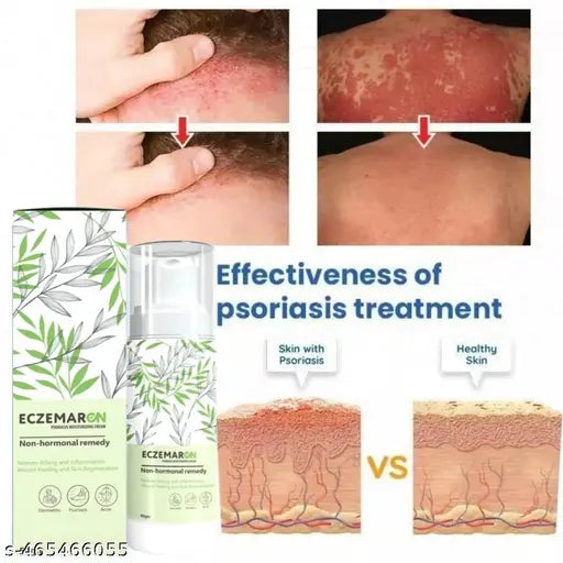 Eczemaron Herbal Anti Fungal Spray - (Buy 1 Get 1 FREE🔥🔥)