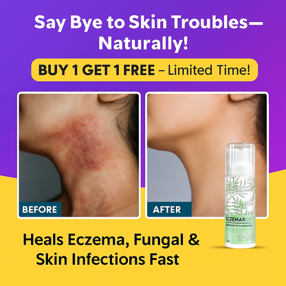 Eczemaron Herbal Anti Fungal Spray - (Buy 1 Get 1 FREE🔥🔥)