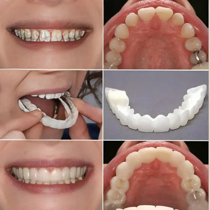 🔥Instant and Confident on Smile Fit Flex Cosmetic Teeth Denture Teeth🔥