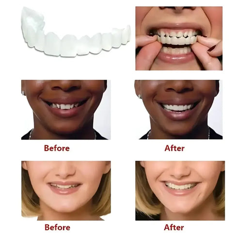 🔥Instant and Confident on Smile Fit Flex Cosmetic Teeth Denture Teeth🔥