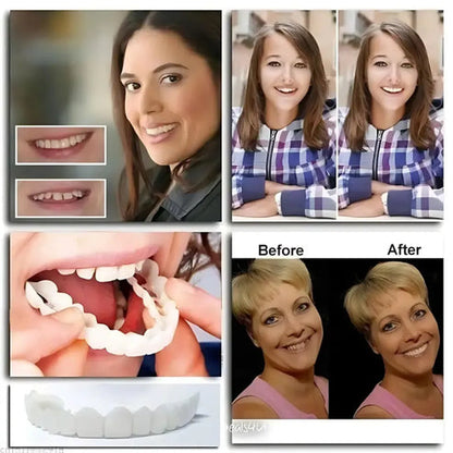 🔥Instant and Confident on Smile Fit Flex Cosmetic Teeth Denture Teeth🔥