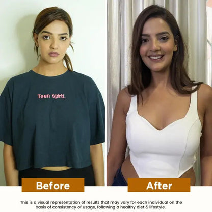 Combo of Breast Oil and Breast Capsule - 100% Herbal Breast Increase Combo